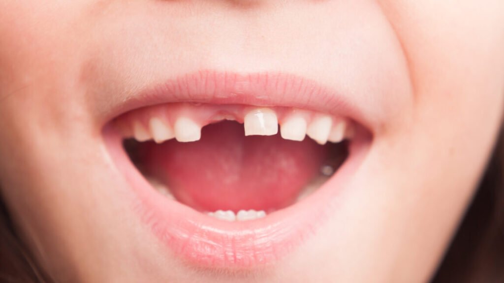 RFK Jr’s plan to ban fluoride supplements will “hurt rural America,” dentists say RFK Jr’s plan to ban fluoride supplements will “hurt rural America,” dentists say