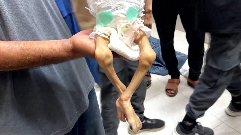 What has Israel’s denial of food done to Gaza’s people? | Israel-Palestine conflict