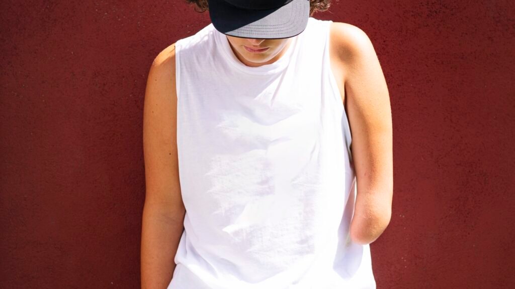 After an amputation, the brain remembers the body's lost limb : Shots