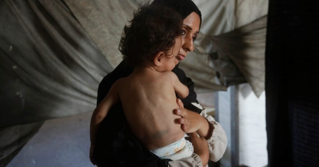 Israel’s starvation denial is an Orwellian farce | Israel-Palestine conflict