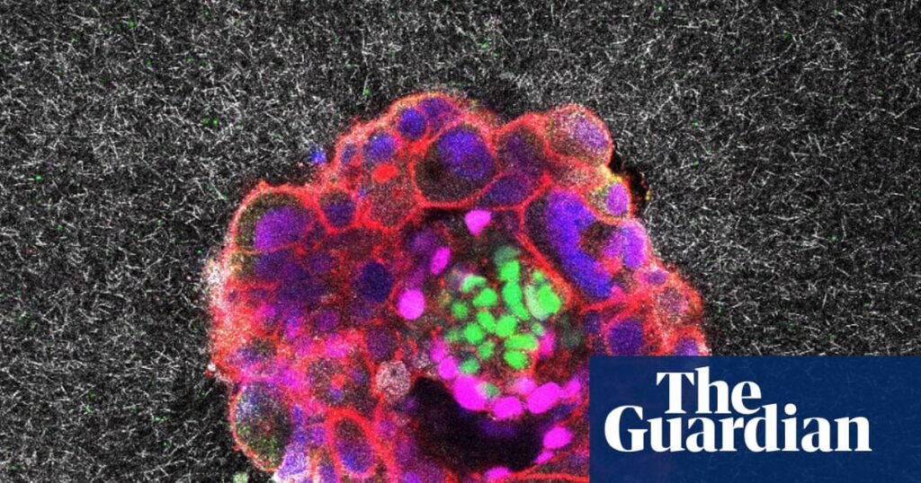 Scientists capture first footage of human embryo implanting in a uterus | Science