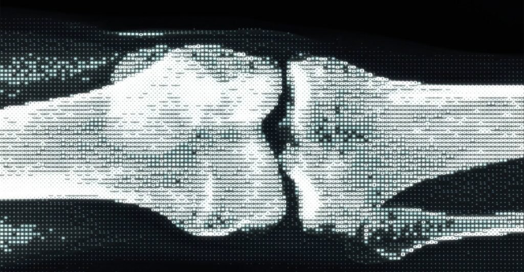 The Trump Administration Will Automate Health Inequities